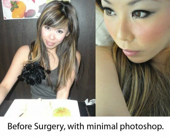 Jacqueline Koh Plastic Surgery