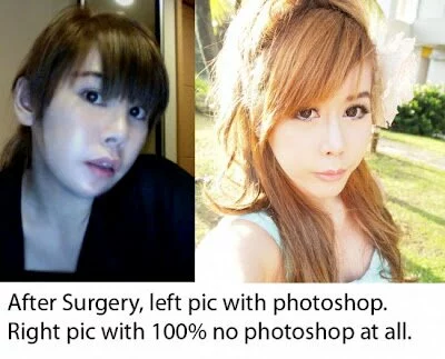 Jacqueline Koh before and after Plastic Surgery